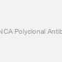 Rabbit Anti-Human SNCA Polyclonal Antibody, Phospho-Tyr125